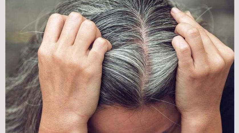 مساحة نت | خلطة طبيعية منزلية خارقة للتخلص من شيب الشعر خلال 3 أيام فقط.. لن تتوقعيها