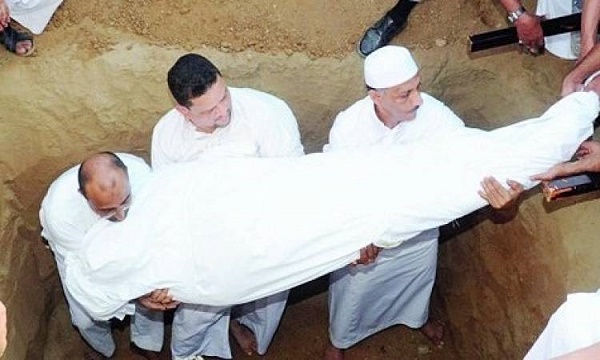 حكم ترقيع الجلد التالف للإنسان الحي بجلد الميت